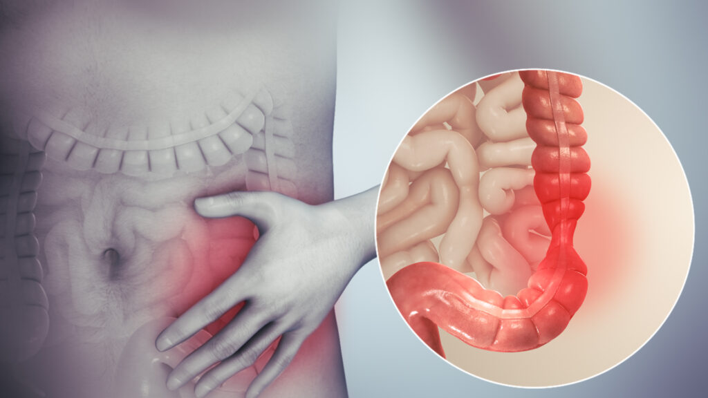 Diagrama de intestino